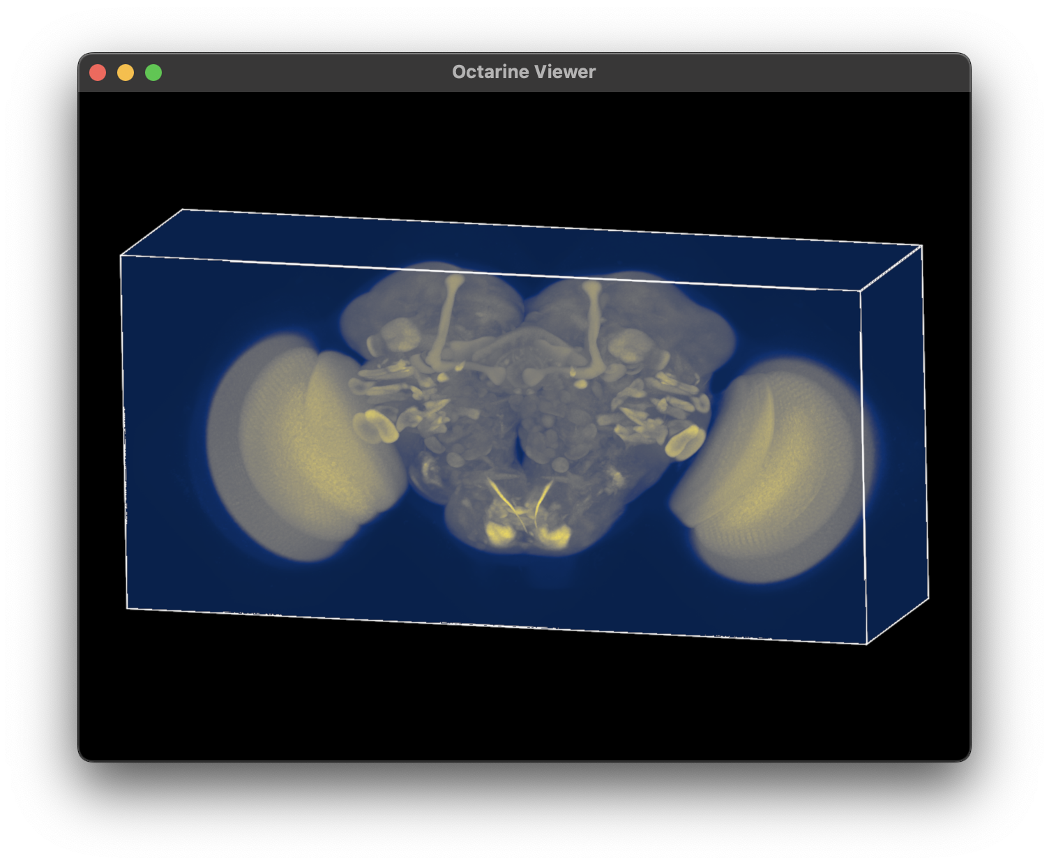 brain volume